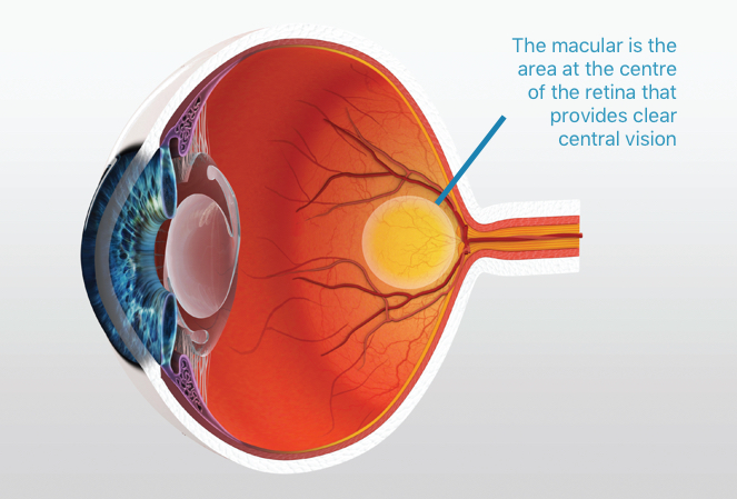 macular degeneration treatment