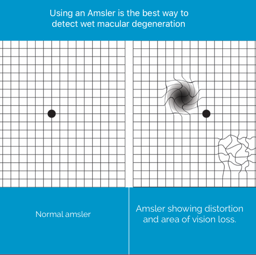 eye test for macular degeneration
