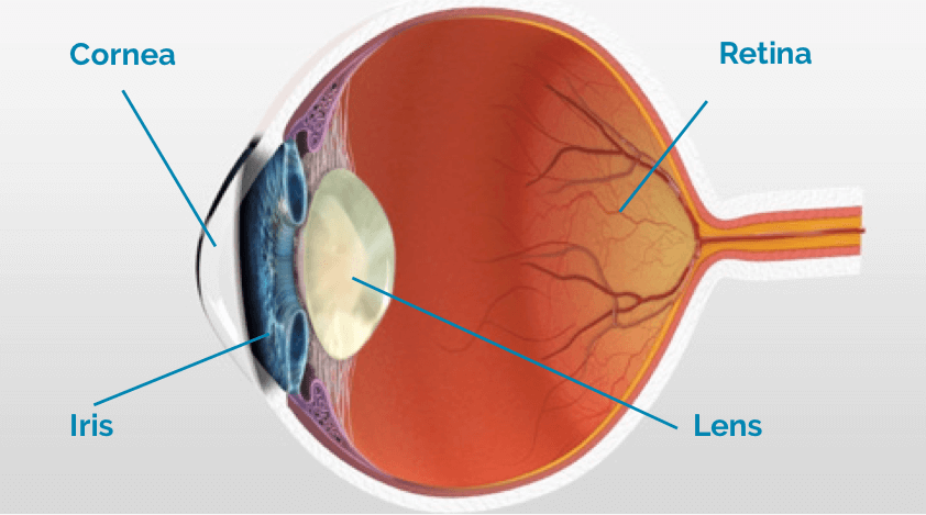 causes cataract surgery