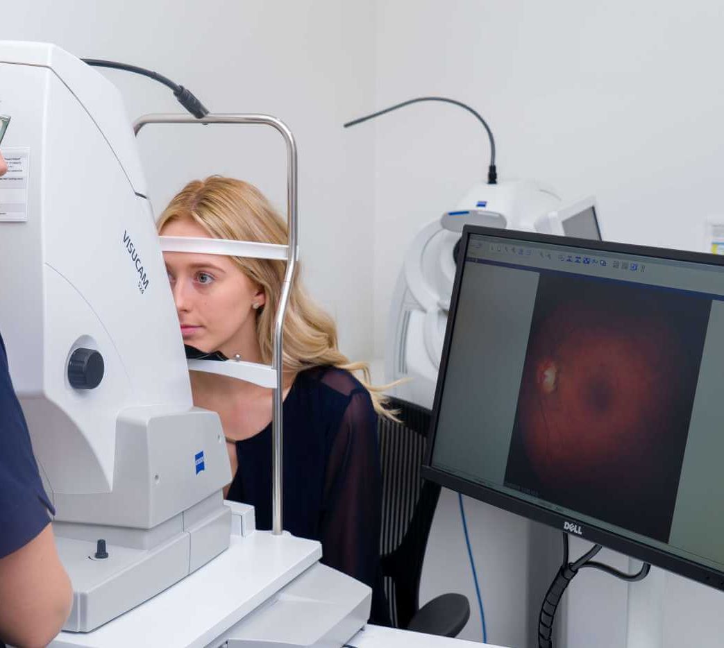 glaucoma laser surgery